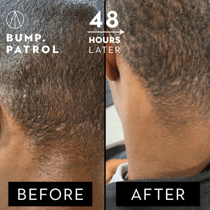 Bump Patrol Aftershave Original